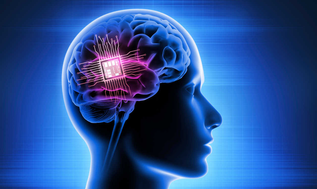 Elon Musk Anuncia La Primera Implantaci N De Chip Cerebral En Un Humano