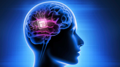 Elon Musk anuncia la primera implantación de chip cerebral en un humano
