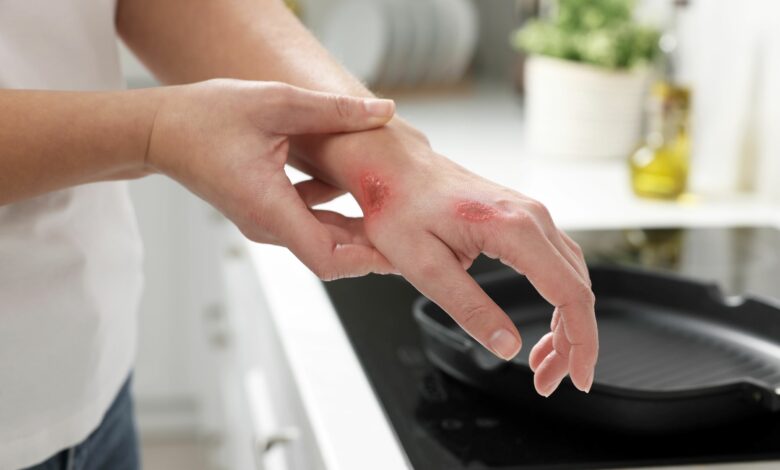 ¿Cómo actuar en caso de accidentes en casa?