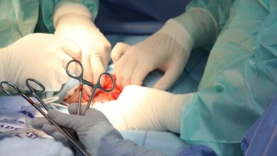 Lima acoge congreso mundial sobre cáncer de mama en medio de cifras alarmantes en Perú